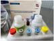 Tuberculosis-Interferon Gamma Release Assay antibody Elisa kit TB-IGRA